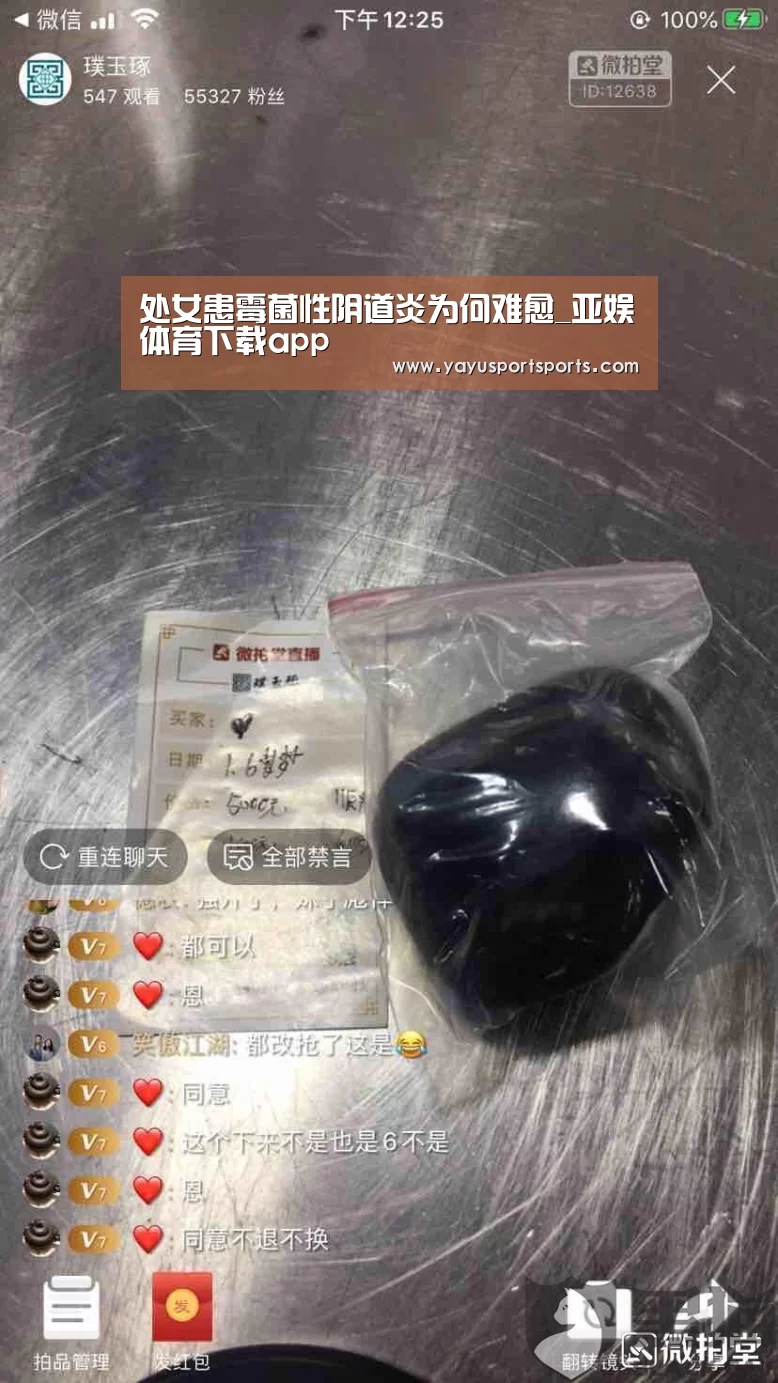处女患霉菌性阴道炎为何难愈_亚娱体育下载app(图2) 亚娱体育体育官网